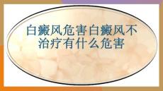 白癜风危害白癜风不治疗有什么危害-优质PPT课件