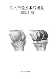 膝关节康复