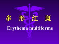 多形红斑Erythemamultiforme课件