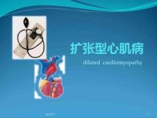 扩张型心肌病--课件