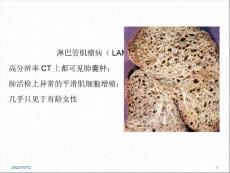 淋巴管肌瘤病的肺部CT表现参考课件