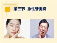 《急性牙髓炎》课件