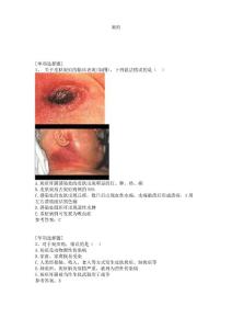 炭疽试题