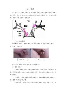 隐睾健康教育