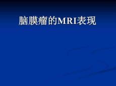 脑膜瘤MRI诊断
