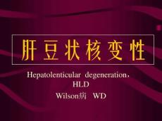 肝豆状核变性ppt课件