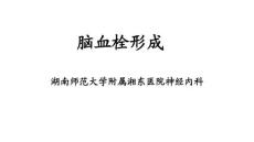 脑血栓形成课件