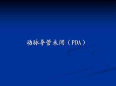 动脉导管未闭12642