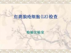 红斑狼疮检查