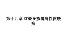 红斑鳞屑性病