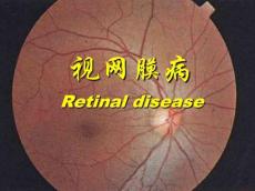 视网膜病图谱