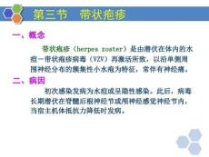 坐骨神经痛