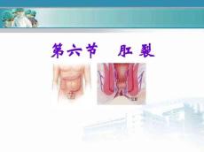 肛裂教学课件