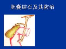 胆囊结石及防治