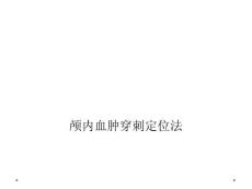 颅内血肿穿刺定位法