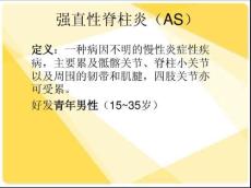 强直性脊柱炎14266
