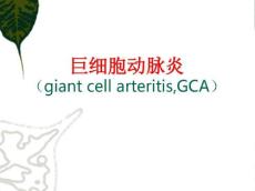 巨细胞动脉炎