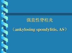 强直性脊柱炎讲课