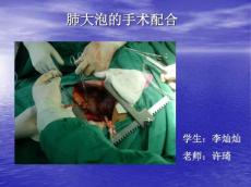 胸腔镜肺大疱切除