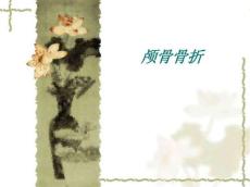 颅骨骨折演示稿
