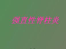 强直性脊柱炎