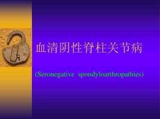 AS血清阴性脊柱关节病