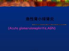 急性肾小球肾炎