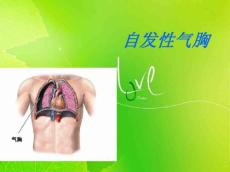 自发性气胸2850