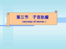 子宫肌瘤10646