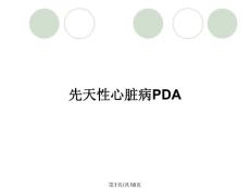 先天性心脏病PDA