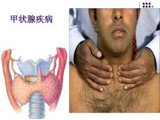甲亢系统