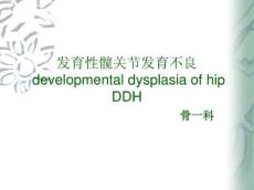 发育性髋关节发育不良
