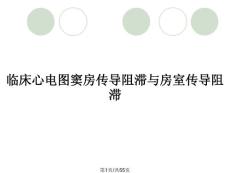 临床心电图窦房传导阻滞与房室传导阻滞