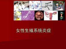 阴道炎ppt课件