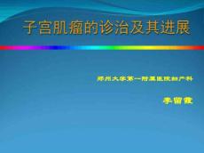 子宫肌瘤诊治
