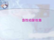 急性动脉栓塞