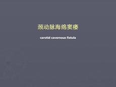 外科学教学课件：颈动脉海绵窦瘘