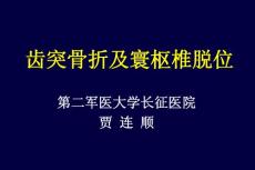 齿突骨折与寰枢椎脱位课件