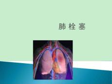肺栓塞课件