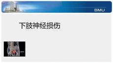 (57)--64.3下肢神经损伤的临床表现；梨状肌综合征的病因及临床表现