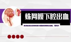 蛛网膜下腔出血
