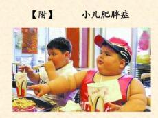单纯性肥胖症