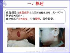 血管瘤的护理