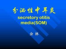 分泌性中耳炎急性化脓性中耳炎