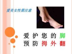 预防拇外翻