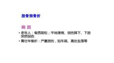 股骨颈骨折