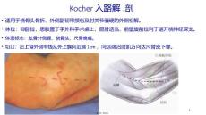 肘关节外侧入路解剖ppt课件