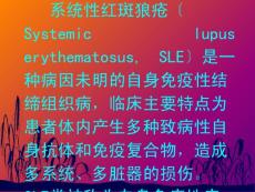 系统性红斑狼疮3920