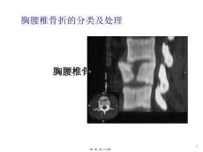 胸腰椎骨折ppt课件