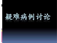 病例讨论多发性骨髓瘤